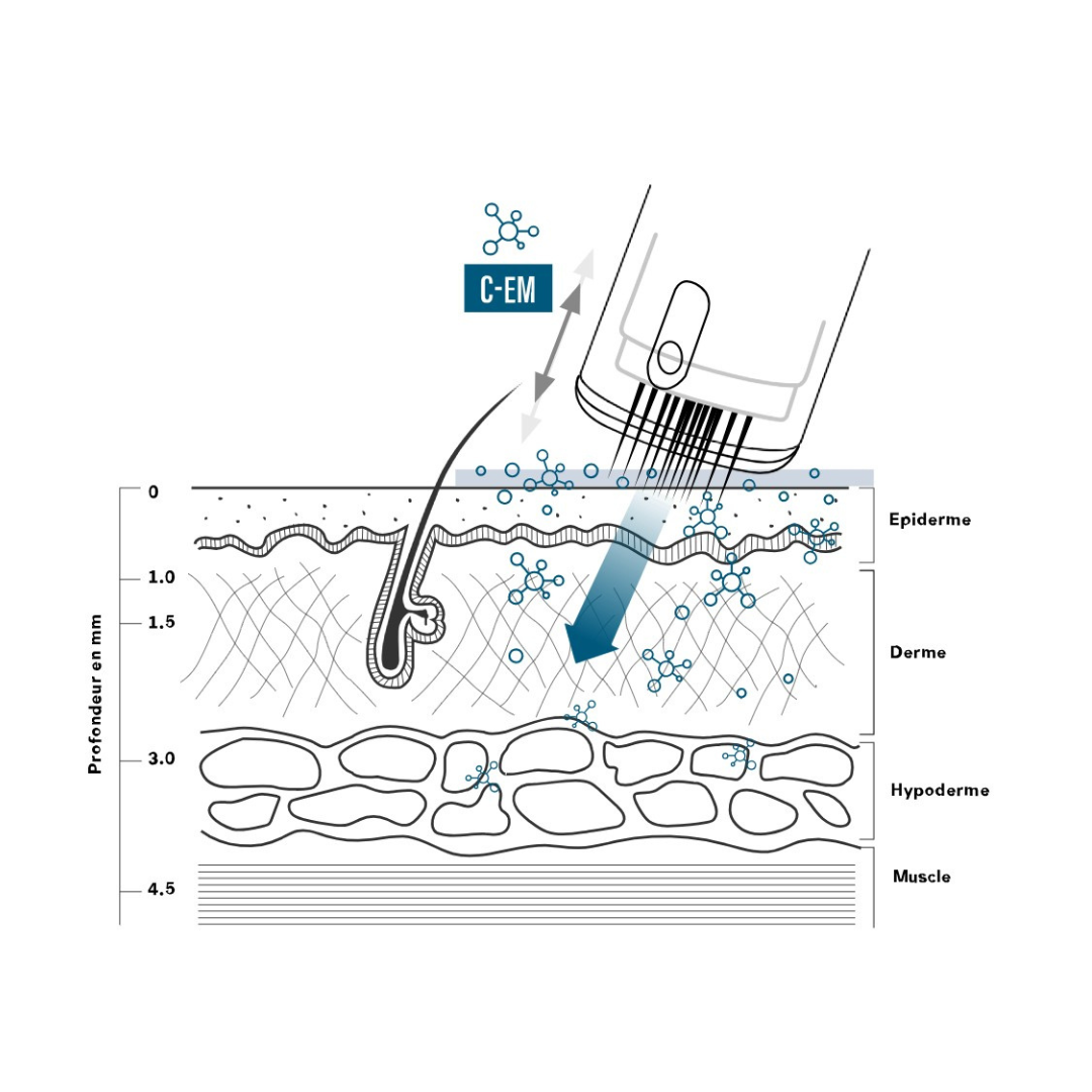Microneedling soins visage, corps et cuir chevelu, au centre dermoeclat,microstimulation et hairneedling sérums