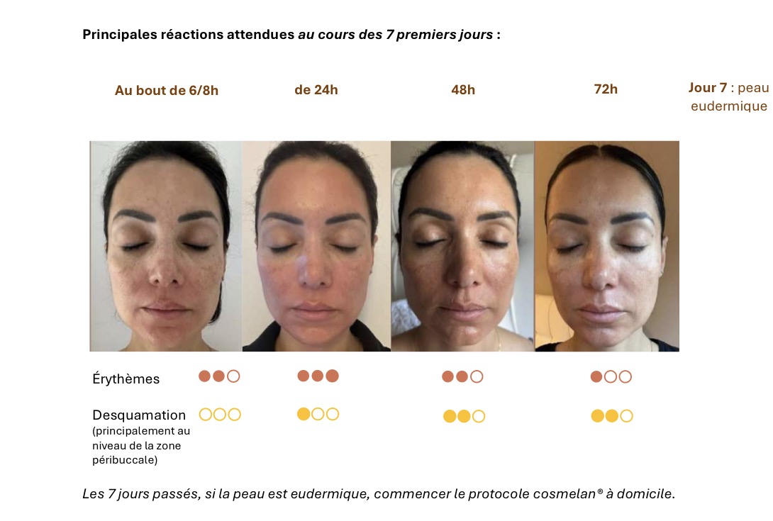 soin du visage teint irrégulier, taches dermo-esthtique centre dermoEclat Bouc Bel Air