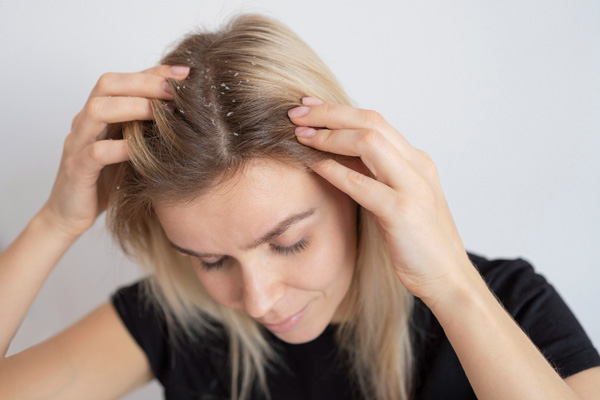 cuir chevelu abime soins dermEclat dermo-esthtique bouc bel air